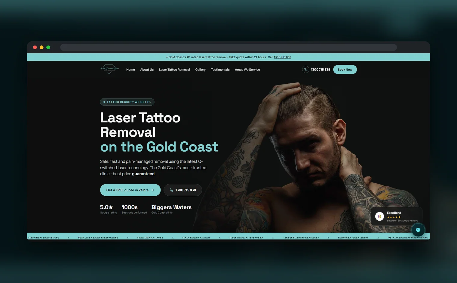 White Diamond Laser website design by Balar Media Group