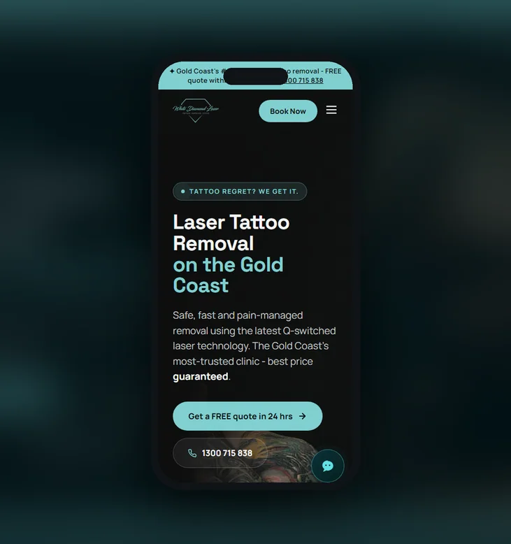 White Diamond Laser mobile website by Balar Media Group